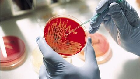 bakterijska kultura za prostatitis za predpisovanje antibiotikov